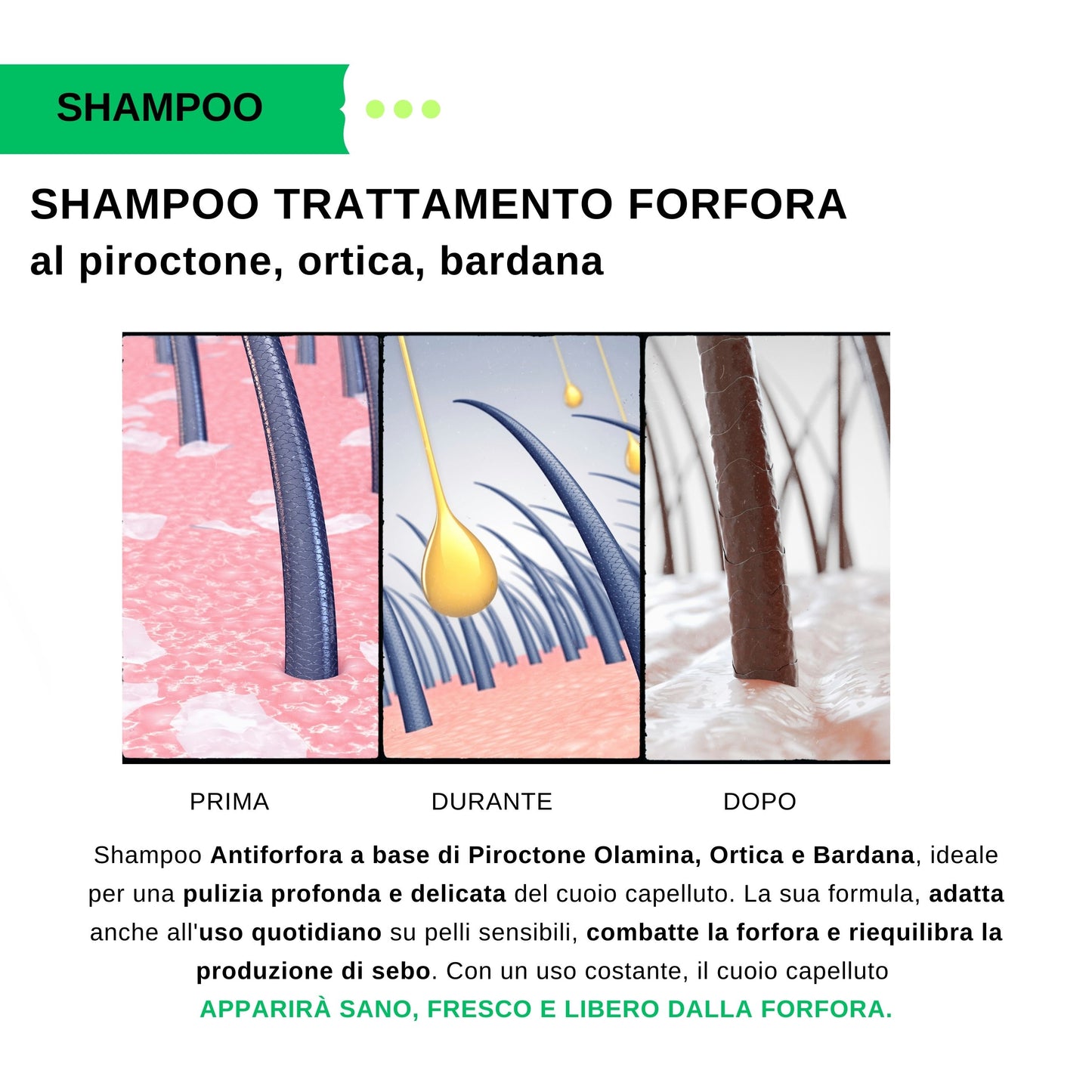 SHAMPOO TRATTAMENTO FORFORA  piroctone ortica e bardana 200 ml